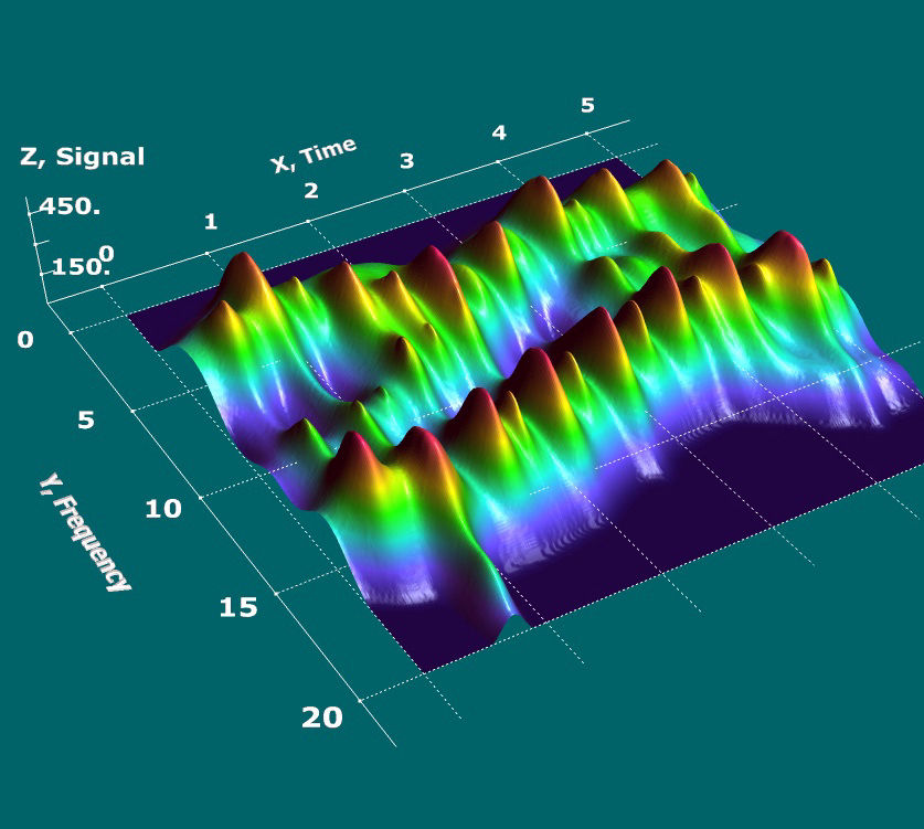 petticoat Je zal beter worden Nieuwe betekenis Advanced Visualization in EEG and biofeedback